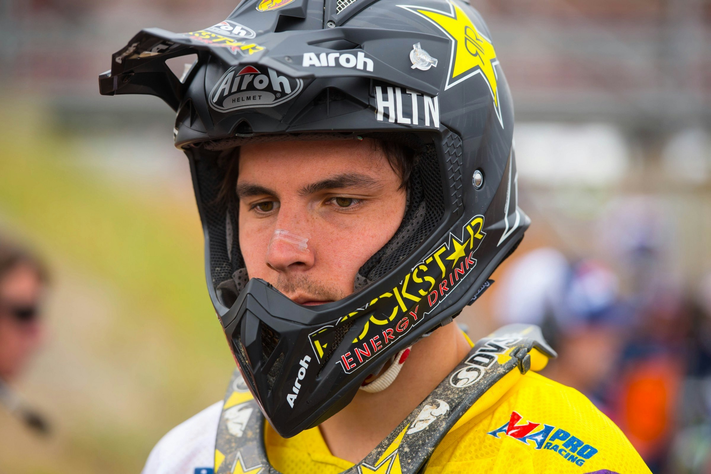 Jason Anderson Expected to Miss 6-8 Weeks