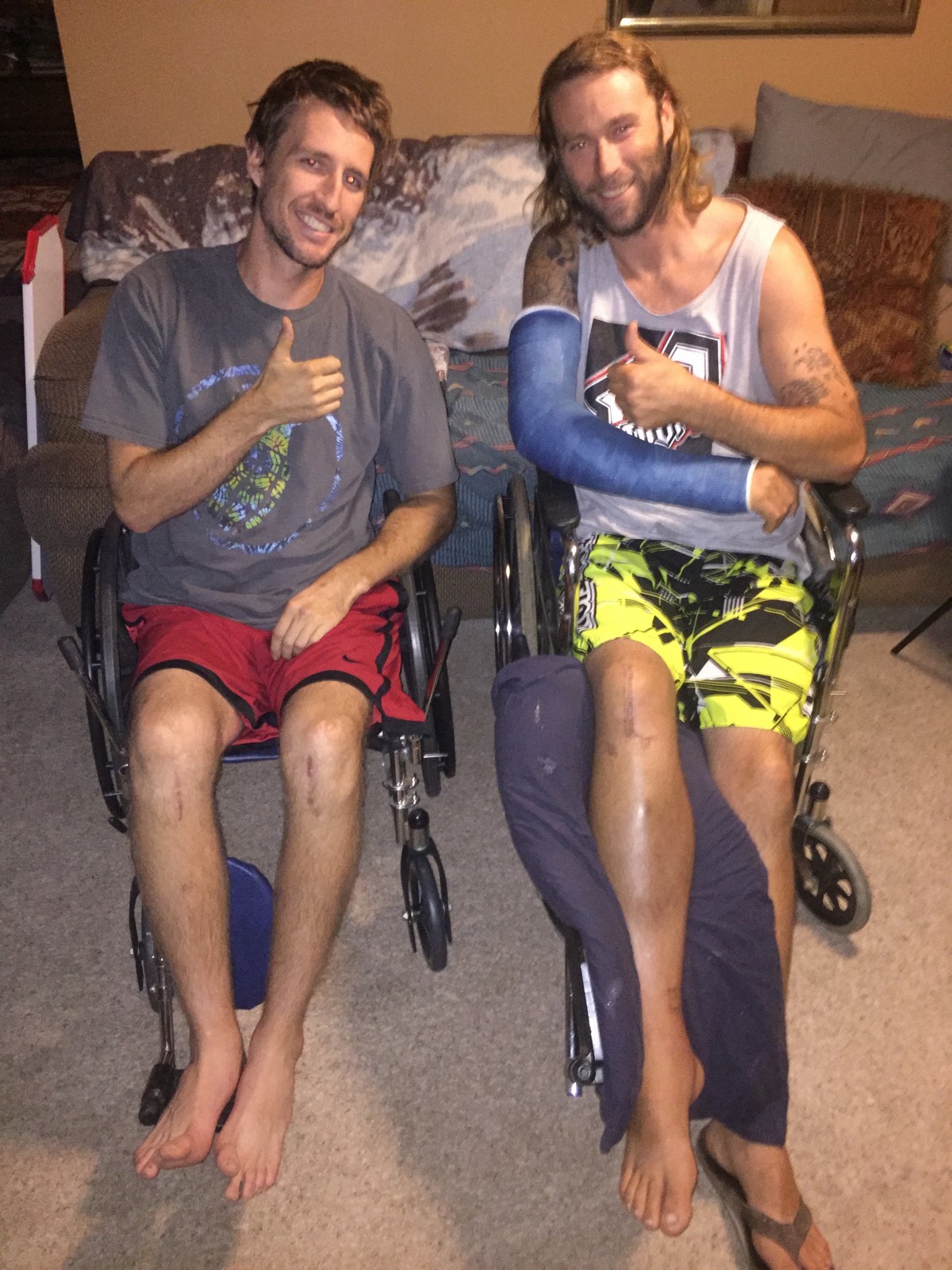 Sewell and Gillen share broken leg stories.
