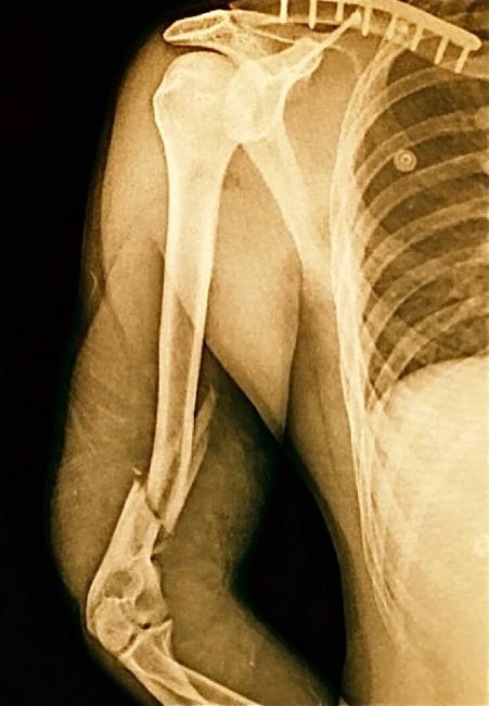 Bogle celebrates his first win of 2015. 