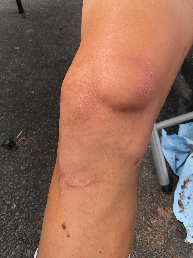 A-Ray's knee has seen better days.