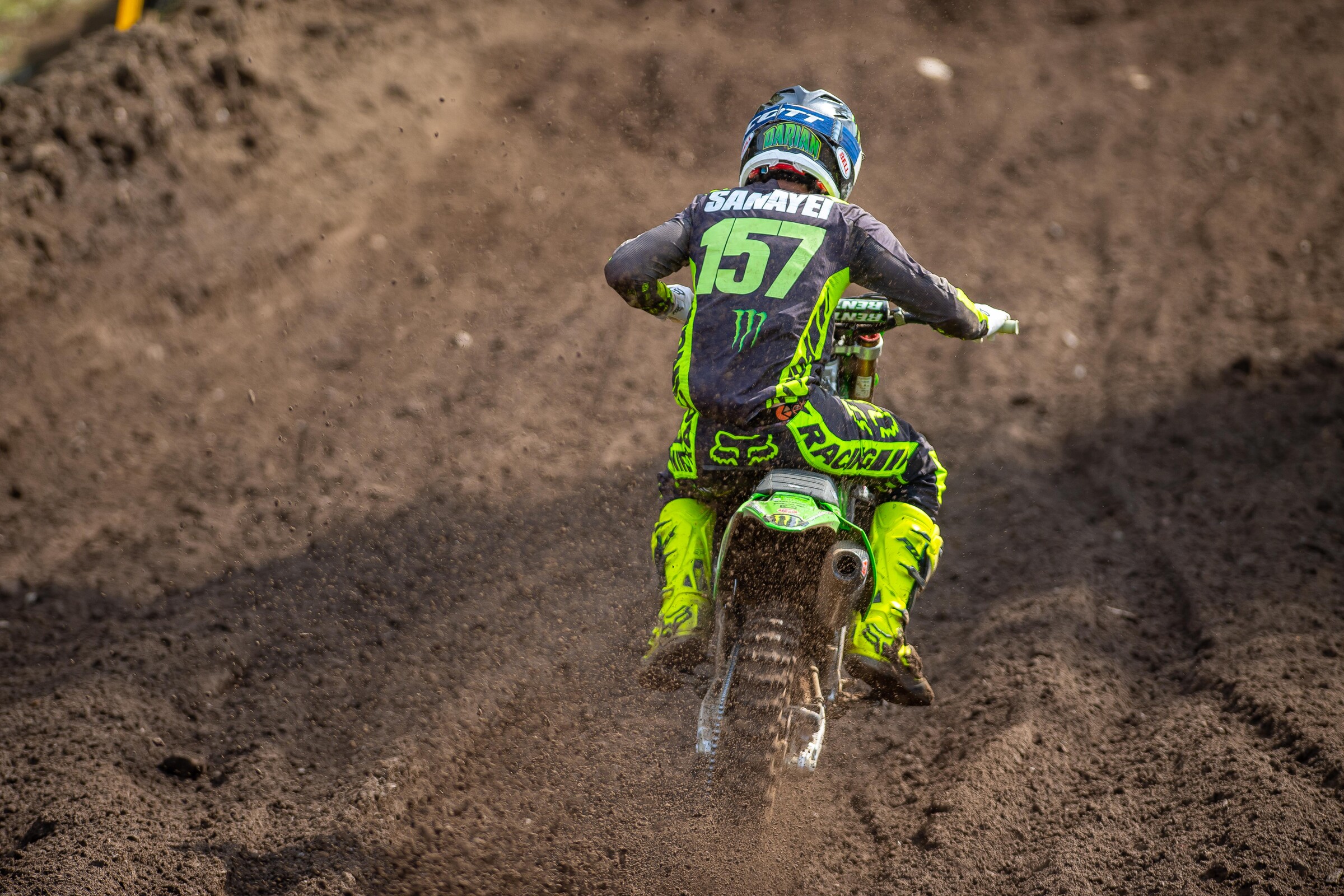 Darian Sanayei will undergo surgery on his shoulder and will be out for the rest of the year.