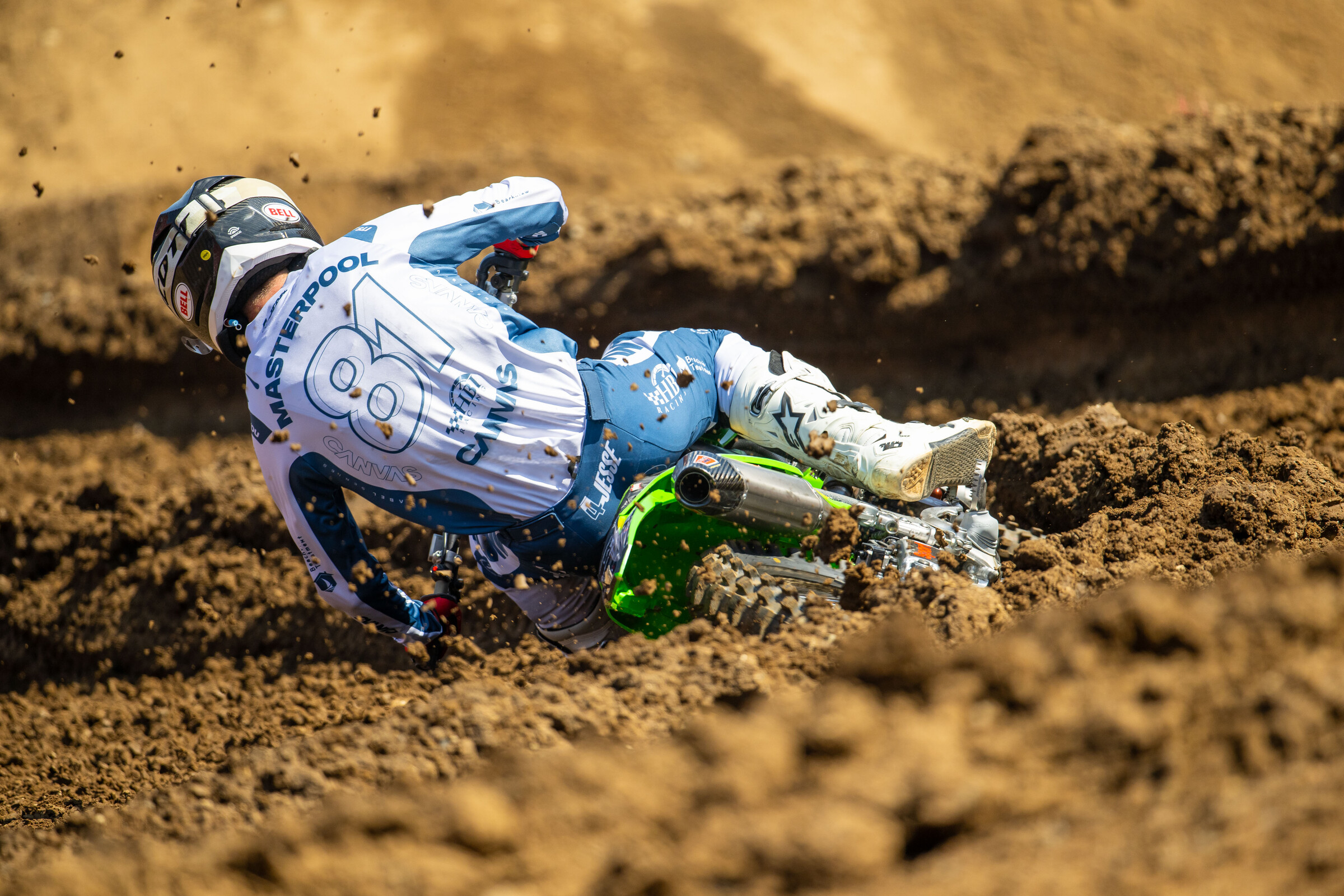 Ty Masterpool will undergo surgery for his appendicitis on Tuesday following the SMX finale. 