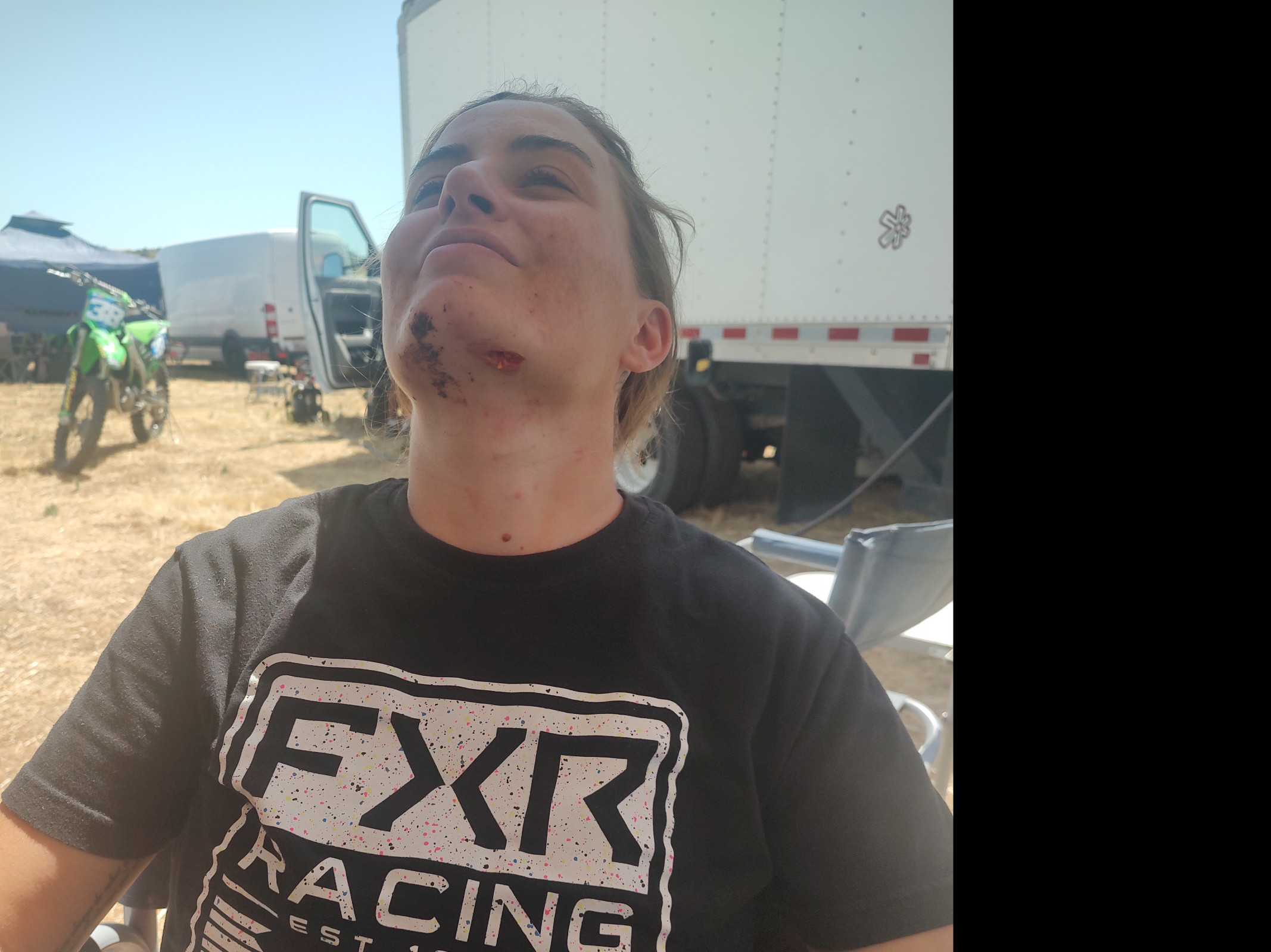 Jarvis was pretty battered after getting landed on in the first moto, but made a heroic return to action in the second.